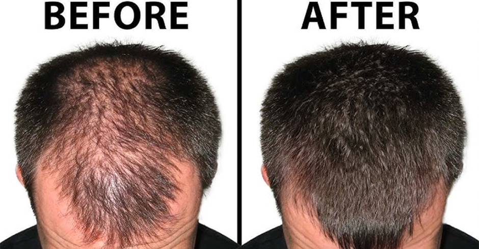 Best Hair Oil for Hair Growth | Premium Natural Formula