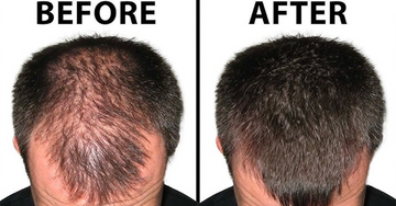 Best Hair Oil for Hair Growth | Premium Natural Formula
