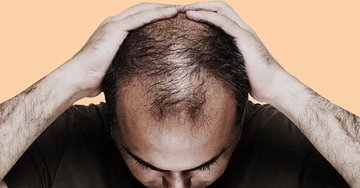 Stop Hair Fall with Bin Sultaan Premium Oil